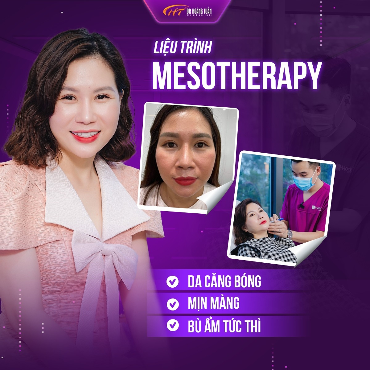 Tiêm Bap và tiêm Meso